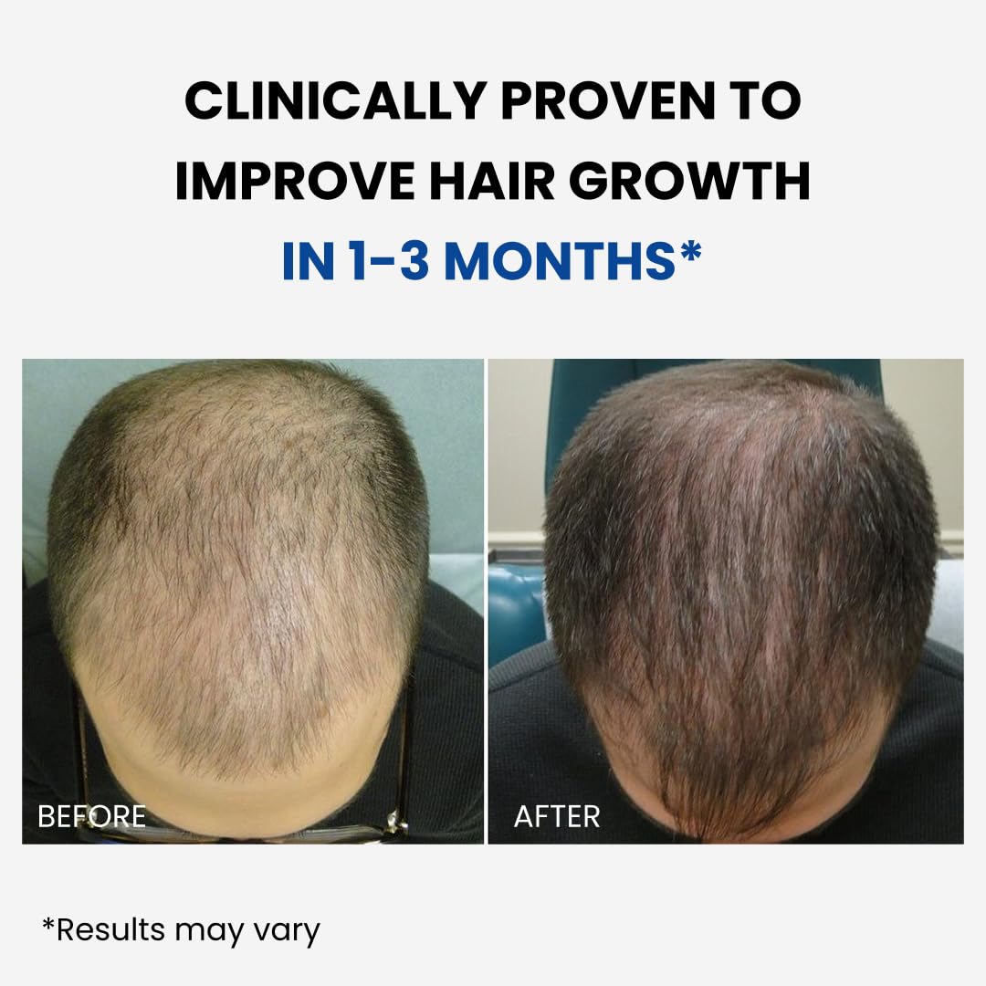 ForHair by Forchics application technique: easy steps for daily use.