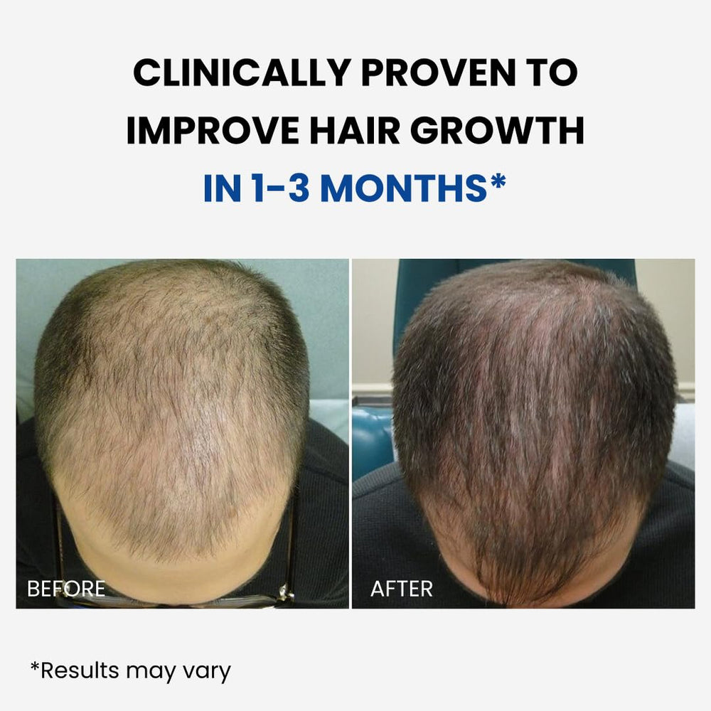 ForHair by Forchics application technique: easy steps for daily use.