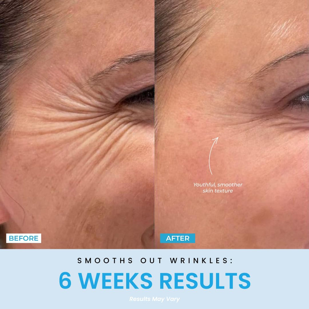 Forchics LiftLab blue mode for clearer skin and texture