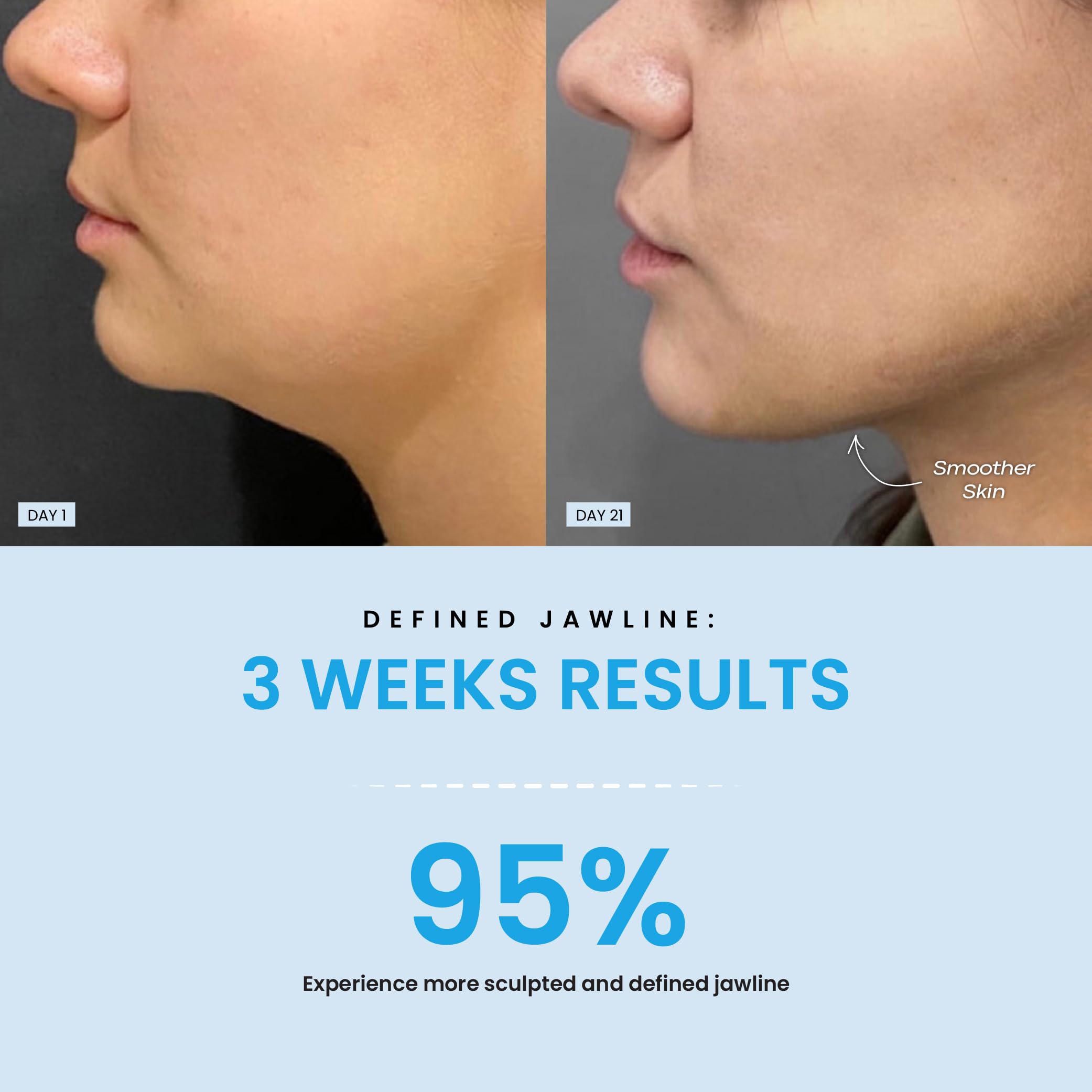 Forchics LiftLab spot care mode improves patchy tone