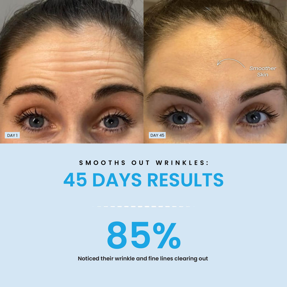 Forchics LiftLab wrinkle care mode for smoother-looking skin