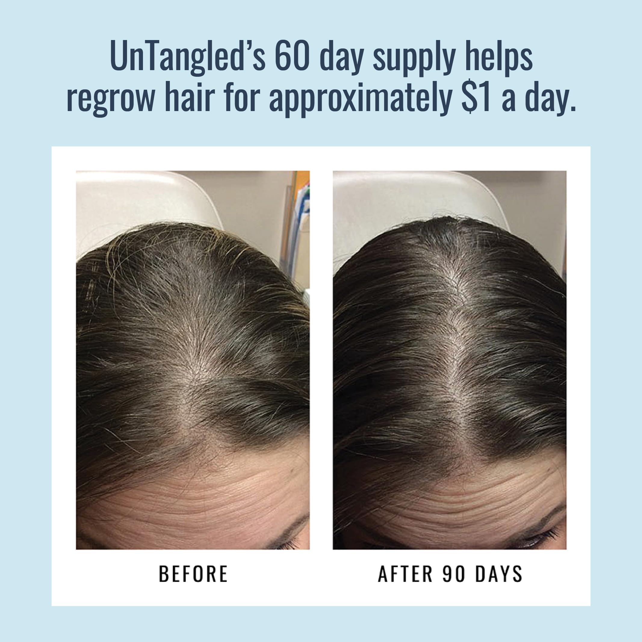 Foundation Skincare UnTangled Hair Vitamins daily-use bottle with a glass of water