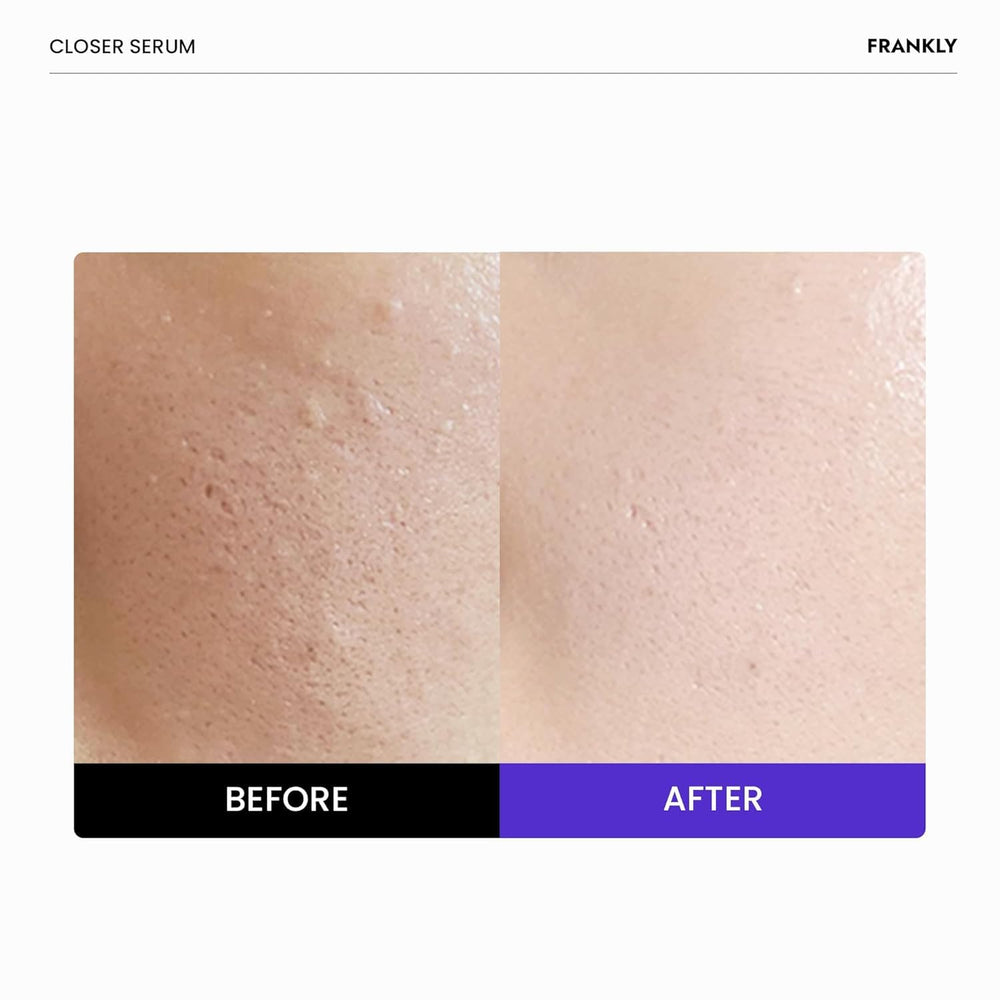 FRANKLY Closer Serum Jumbo texture swatch highlights smooth skin