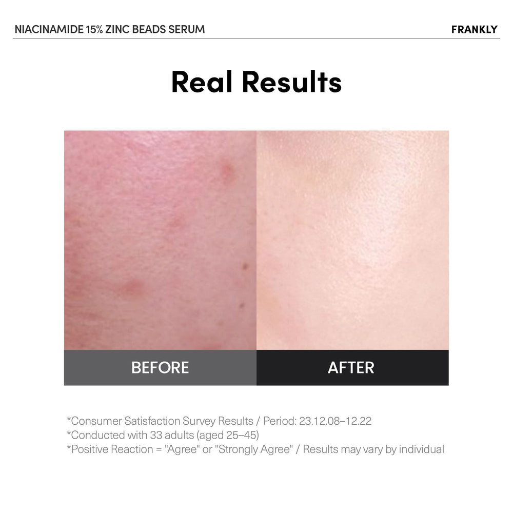 FRANKLY Niacinamide 15% + Zinc Bead Serum encapsulation closeup shows bead activation