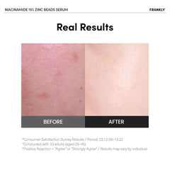 FRANKLY Niacinamide 15% + Zinc Bead Serum encapsulation closeup shows bead activation