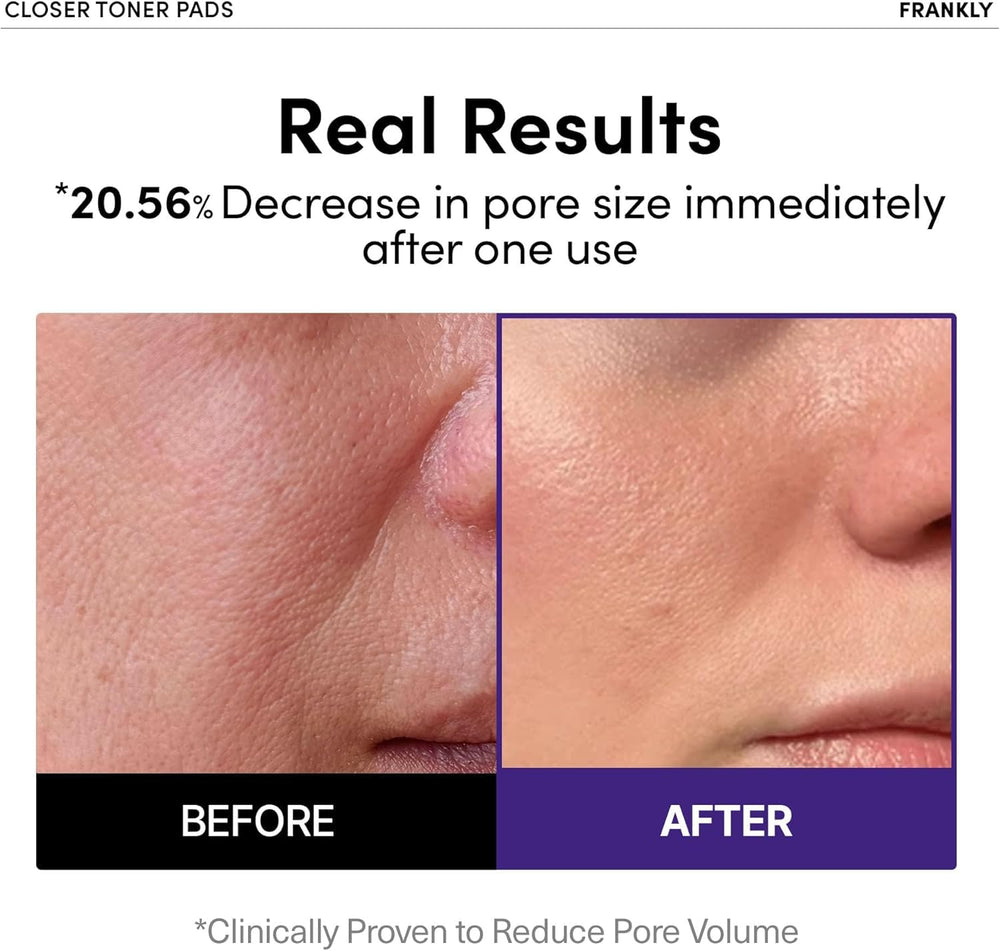 FRANKLY Pore Closer Toner Pad peptide blend tightens pores.