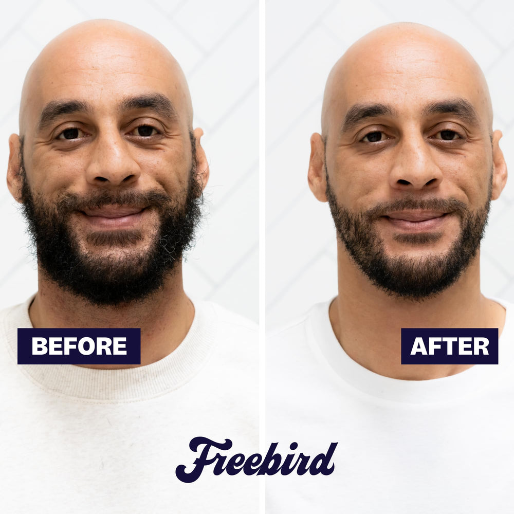 Freebird BeardSeries in use on beard and body for versatile grooming.