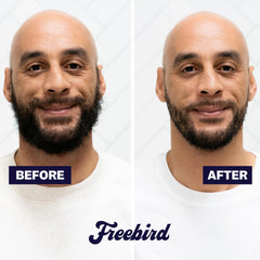 Freebird BeardSeries in use on beard and body for versatile grooming.