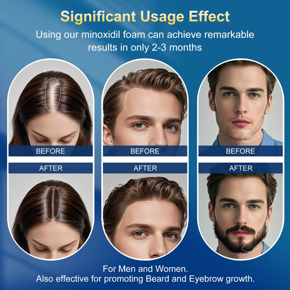 Frnoip foam texture closeup emphasizes silky, quick-absorbing consistency for scalp comfort.