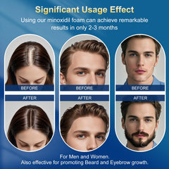 Frnoip foam texture closeup emphasizes silky, quick-absorbing consistency for scalp comfort.