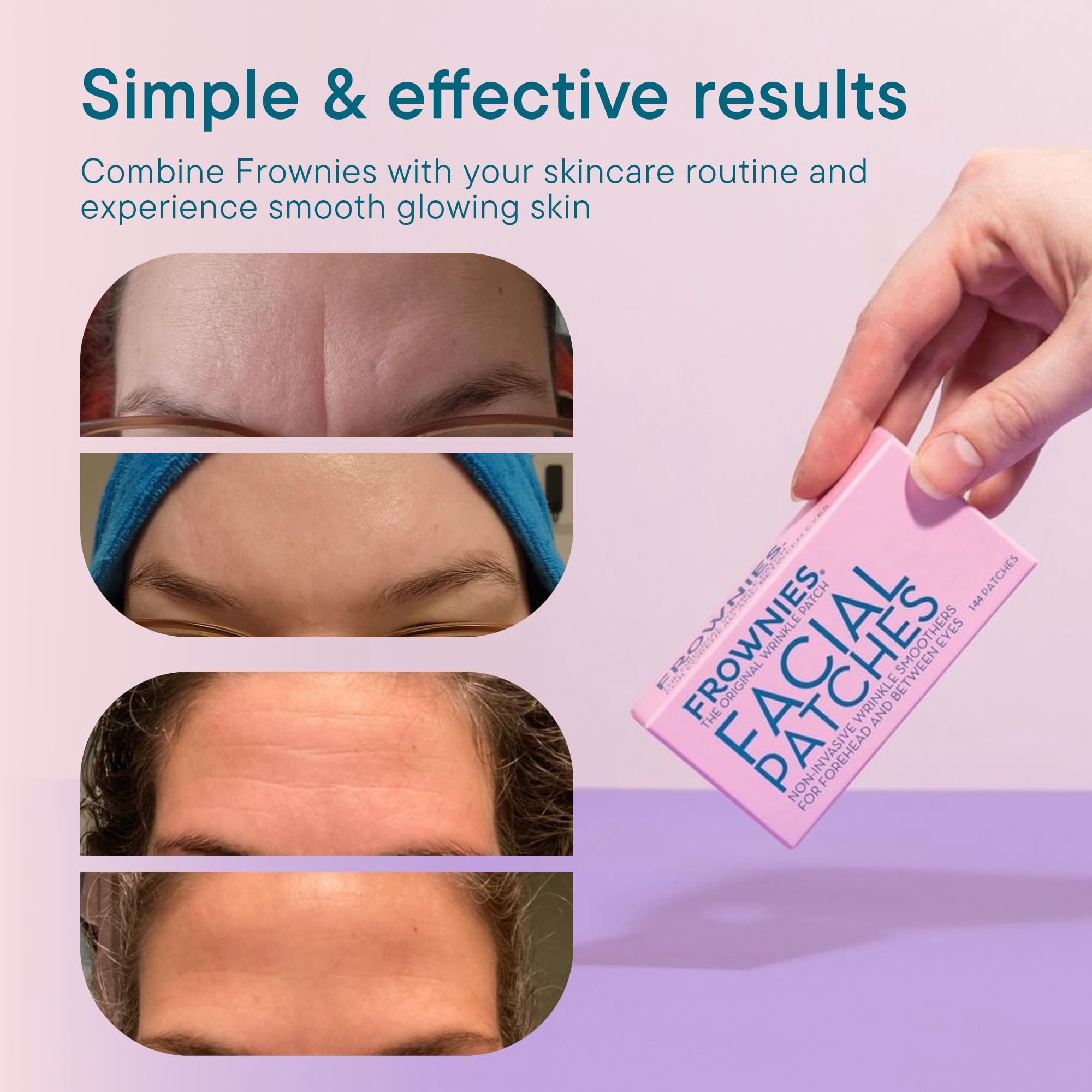 Frownies forehead patches on the face during night use, comfortable and discreet.