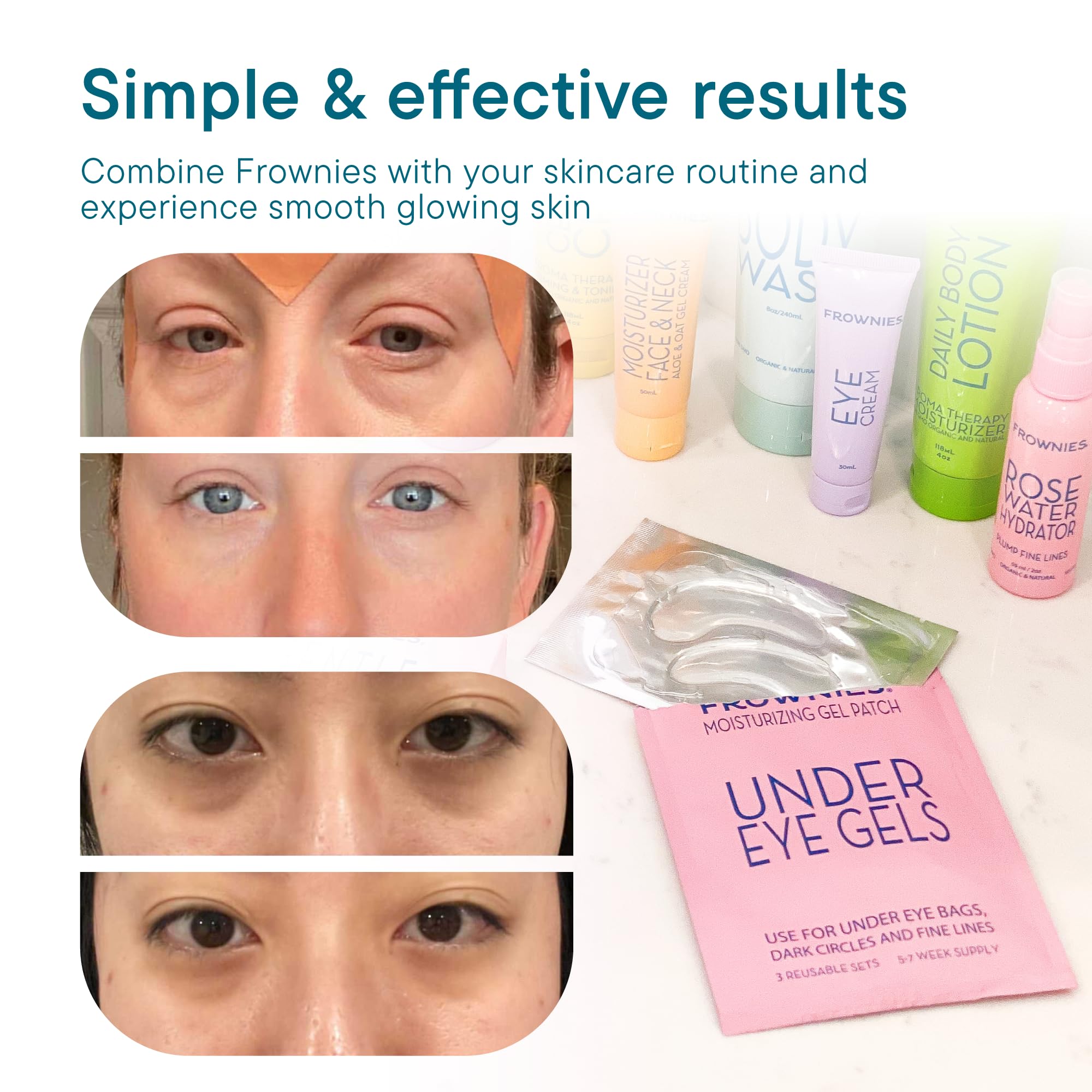Frownies rose water hydrator spray with patches emphasizes hydration boost.