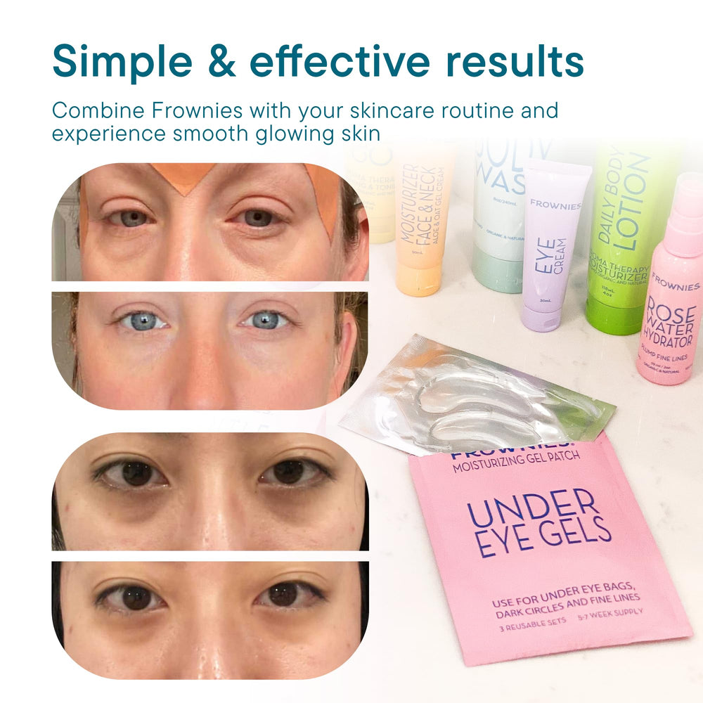 Frownies rose water hydrator spray with patches emphasizes hydration boost.