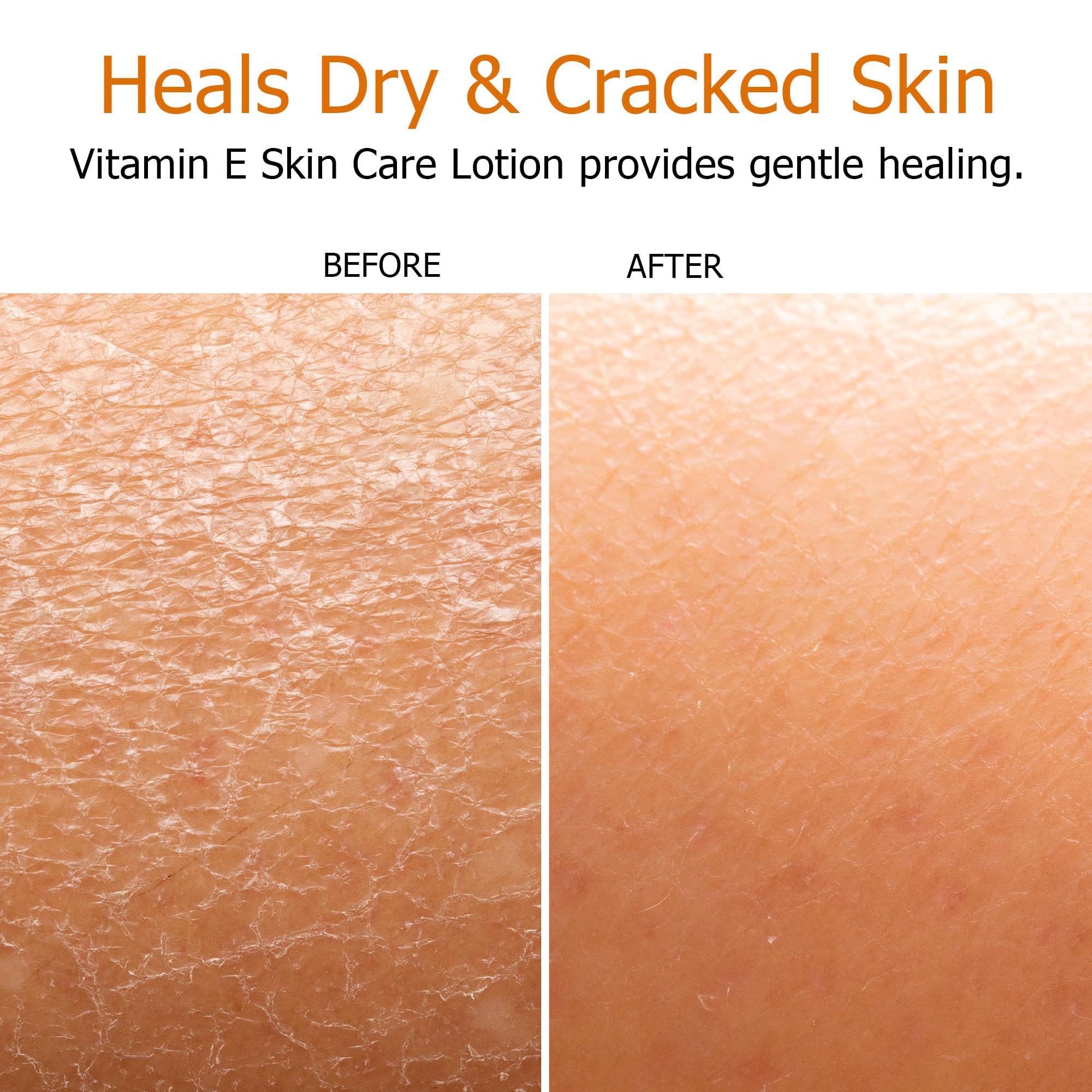 Fruit of the Earth Vitamin E Lotion logo close-up reinforces trusted natural skincare.