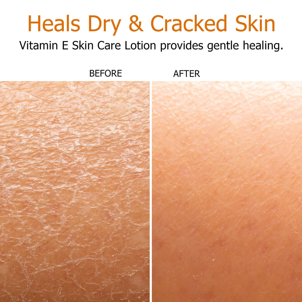 Fruit of the Earth Vitamin E Lotion logo close-up reinforces trusted natural skincare.