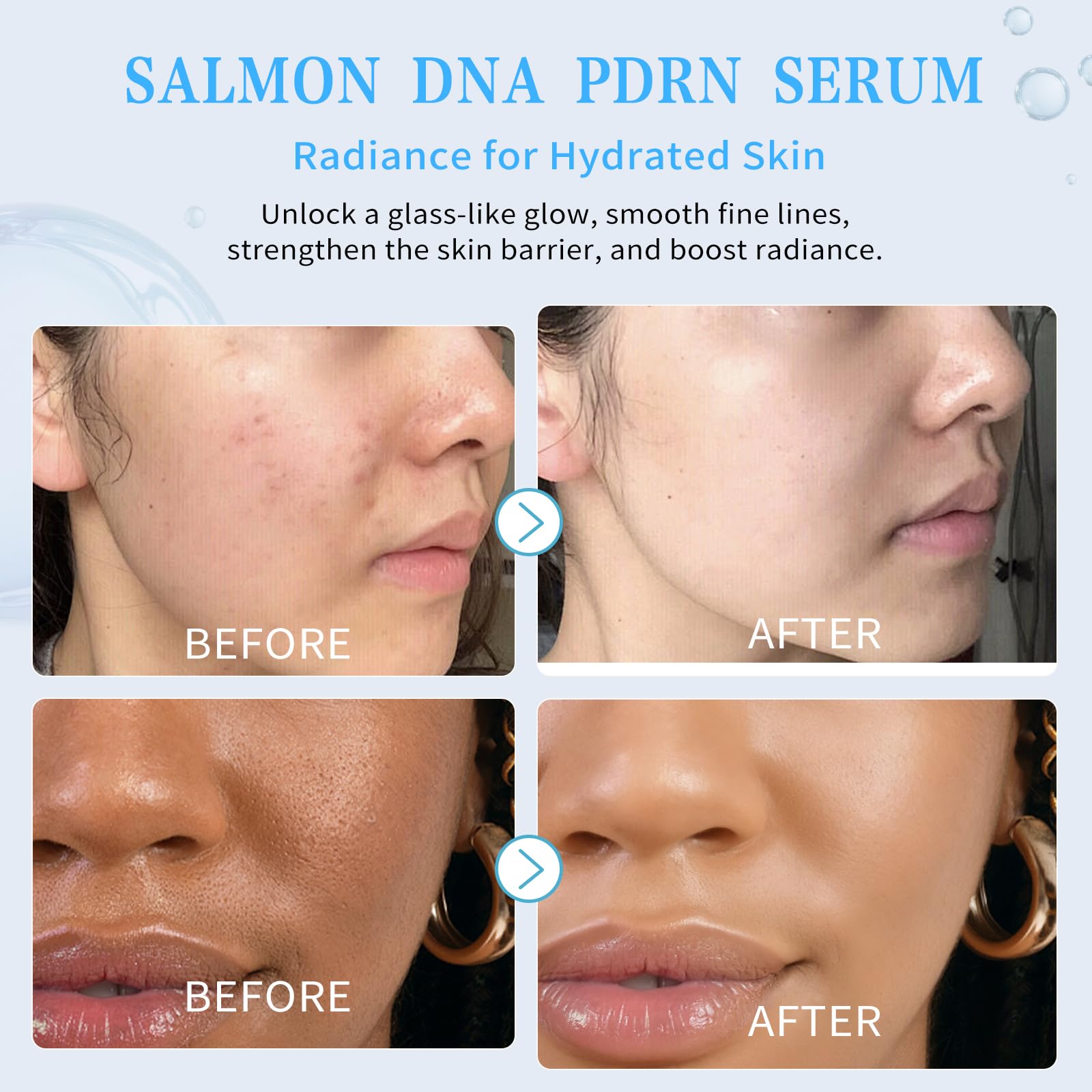 Fstudant Salmon DNA PDRN Serum ampoules packaging emphasizes freshness and hygiene