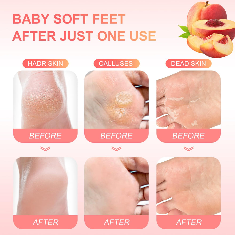 FUNNIR Foot Peeling Mask revitalizes feet with a refreshed, soft-feel look after use.
