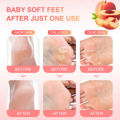 FUNNIR Foot Peeling Mask revitalizes feet with a refreshed, soft-feel look after use.