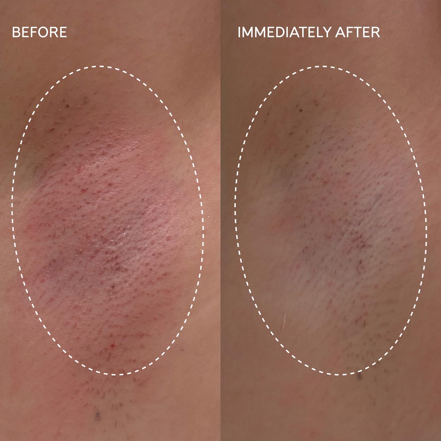 Fur Flash Repair Jelly vegan formula icon signals clean, cruelty-free post-removal care.