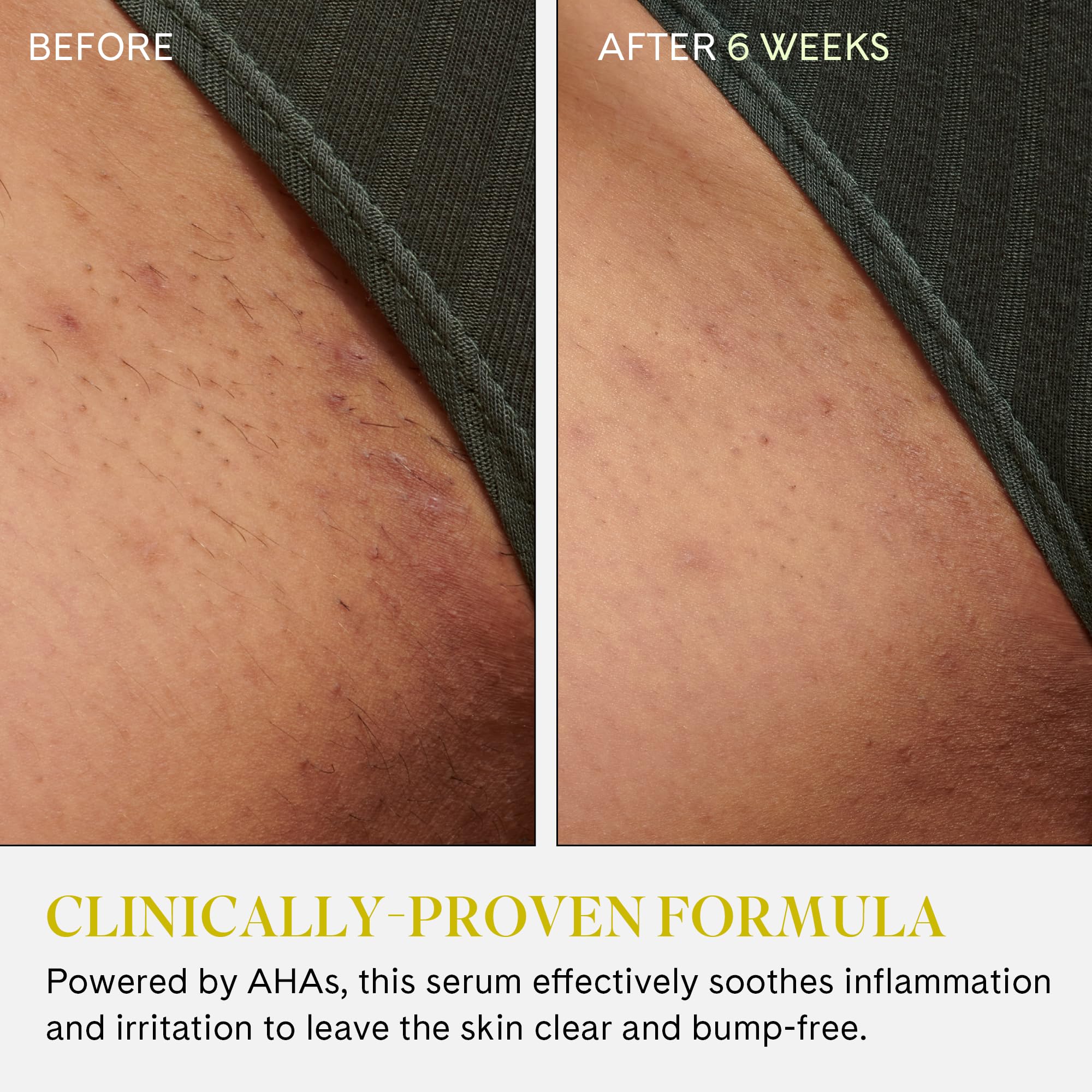Fur Ingrown Eliminator Serum Rollerball vegan packaging suitable for all skin types