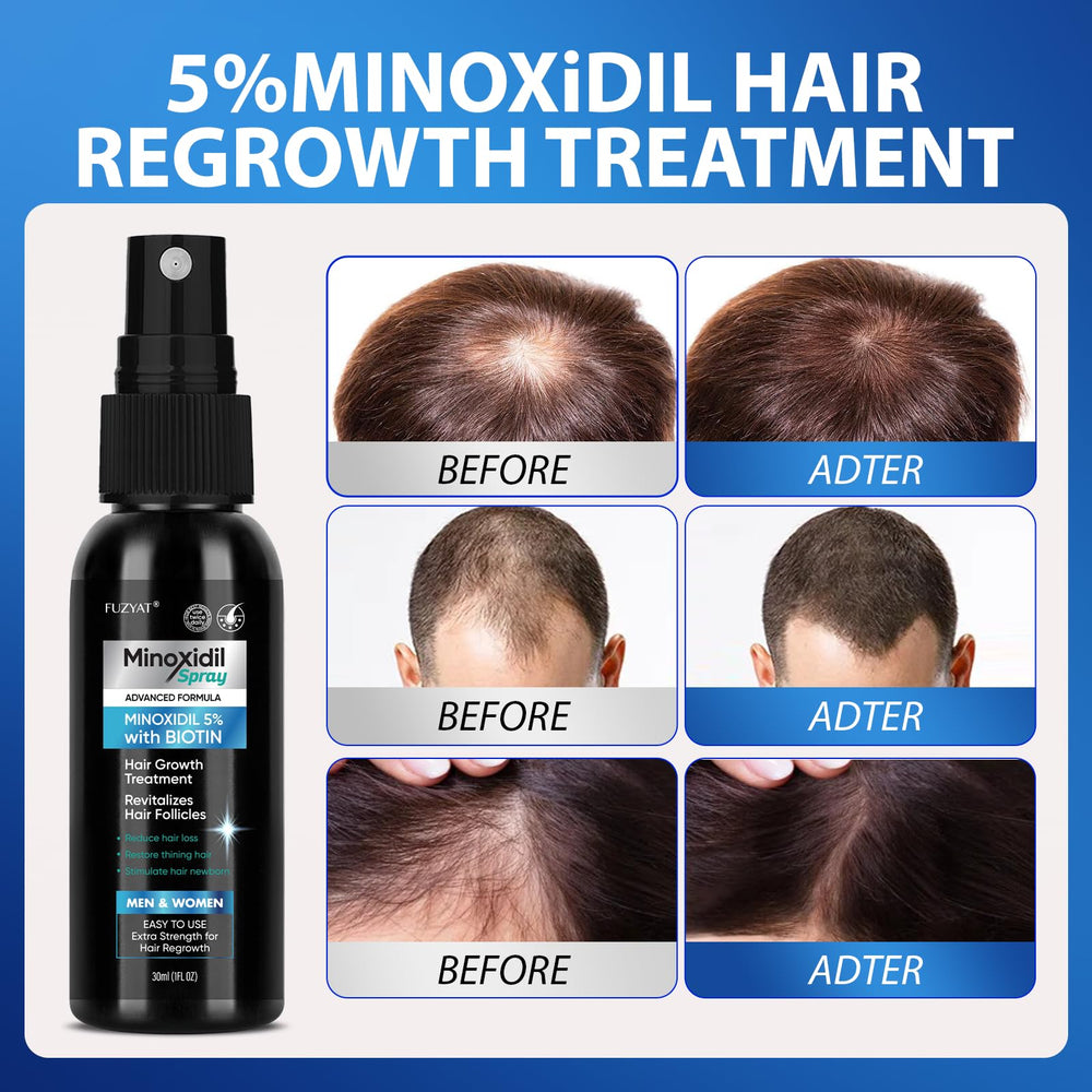 FUZYAT Biotin-Niacinamide formula cap highlights enhanced scalp nourishment.