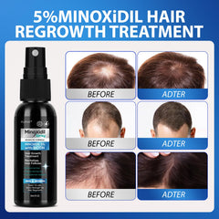 FUZYAT Biotin-Niacinamide formula cap highlights enhanced scalp nourishment.