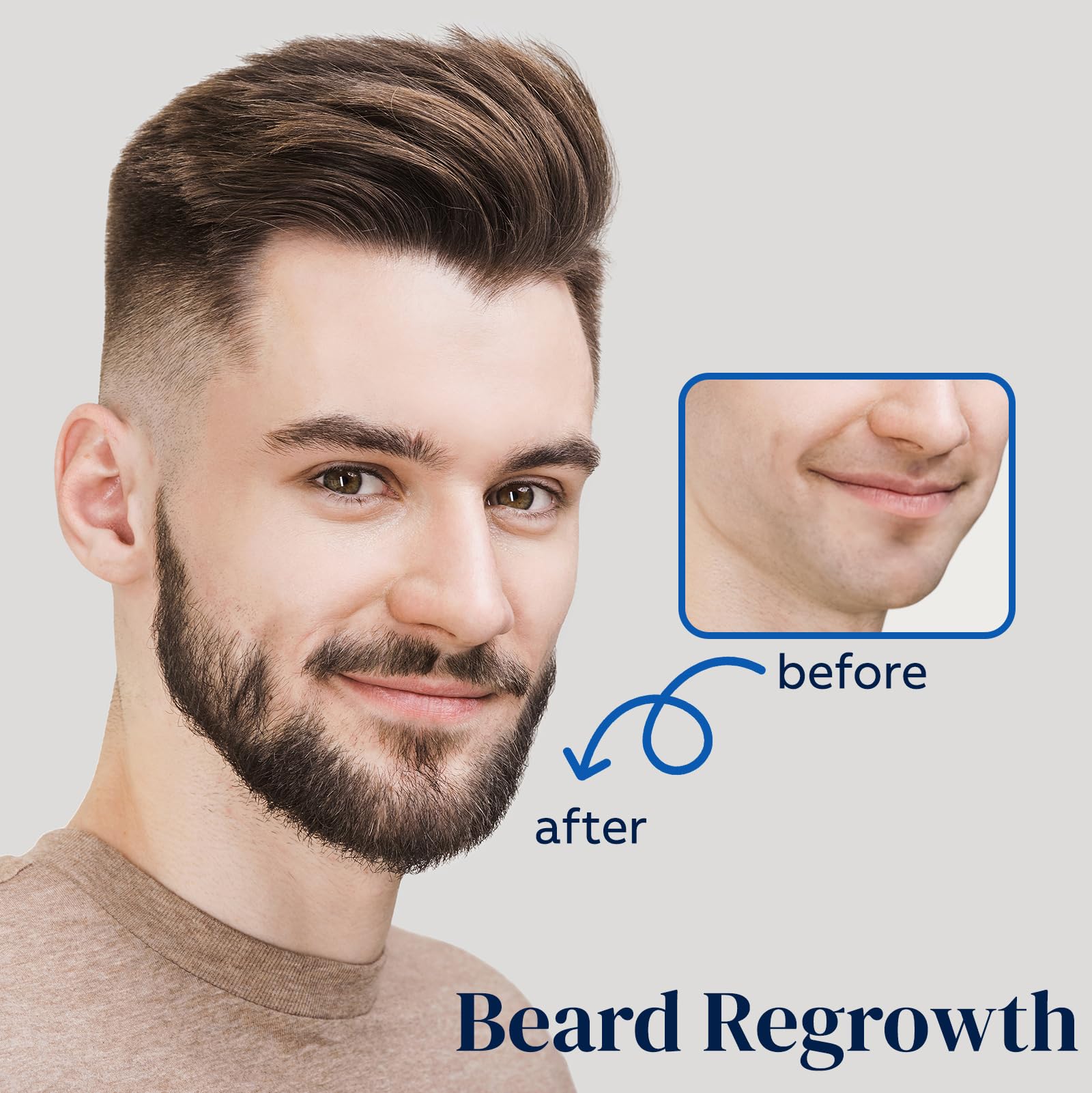 FUZYAT minoxidil beard growth usage—multi-area hair strengthening on facial hair.
