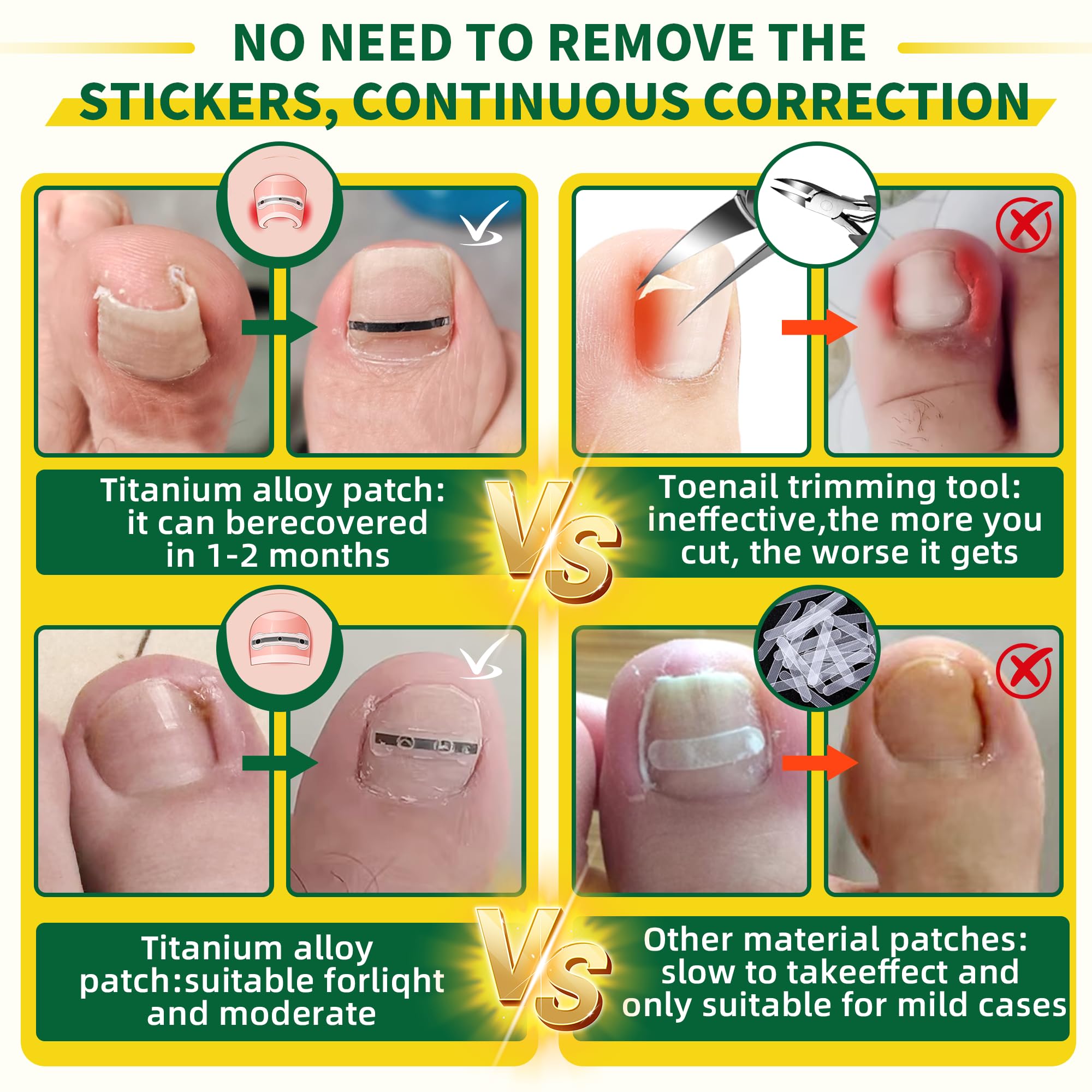 Fuzzycare ingrown toenail kit variations sizes illustrates patches for different nail widths