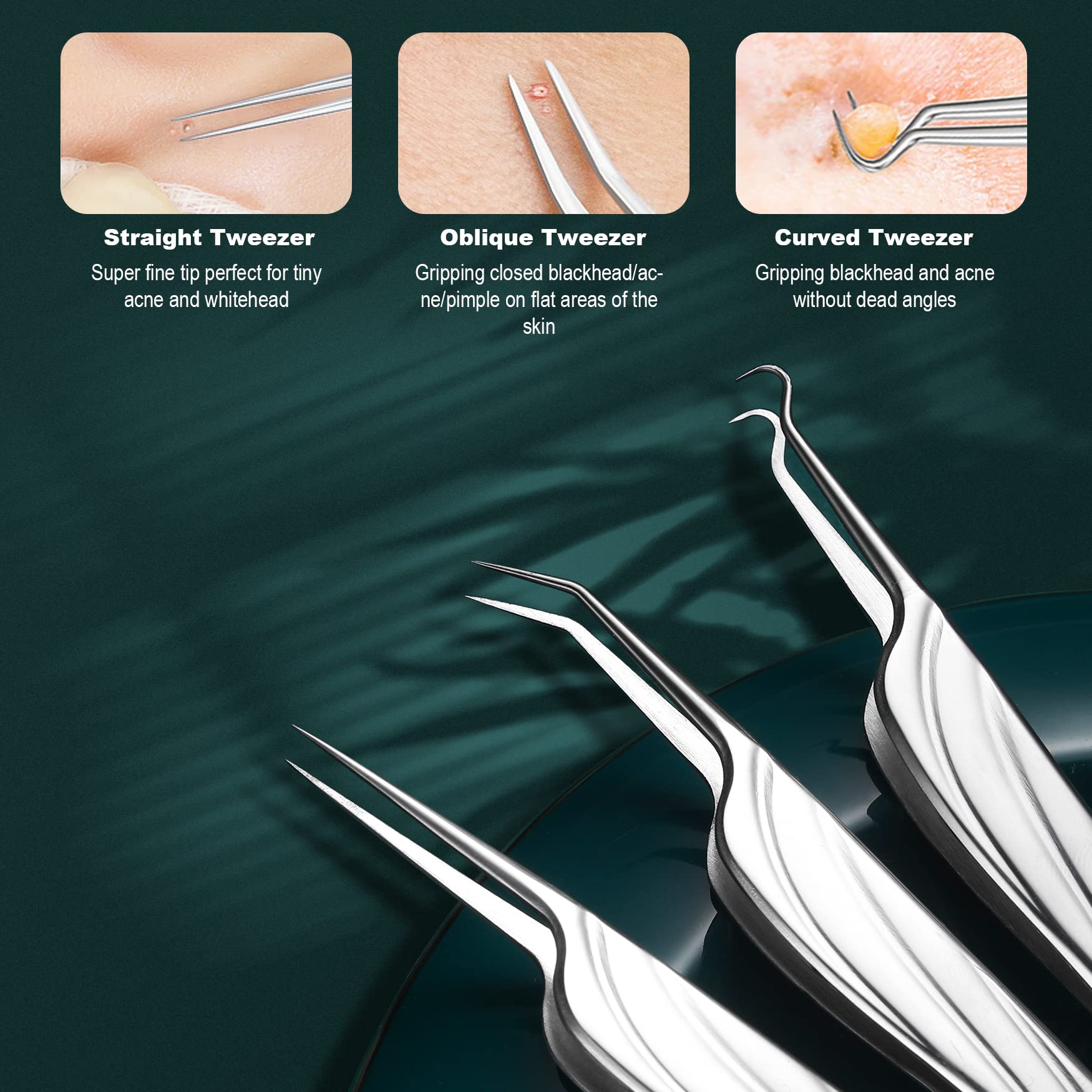 FVION hypoallergenic acne removal tools minimize irritation with non-comedogenic design