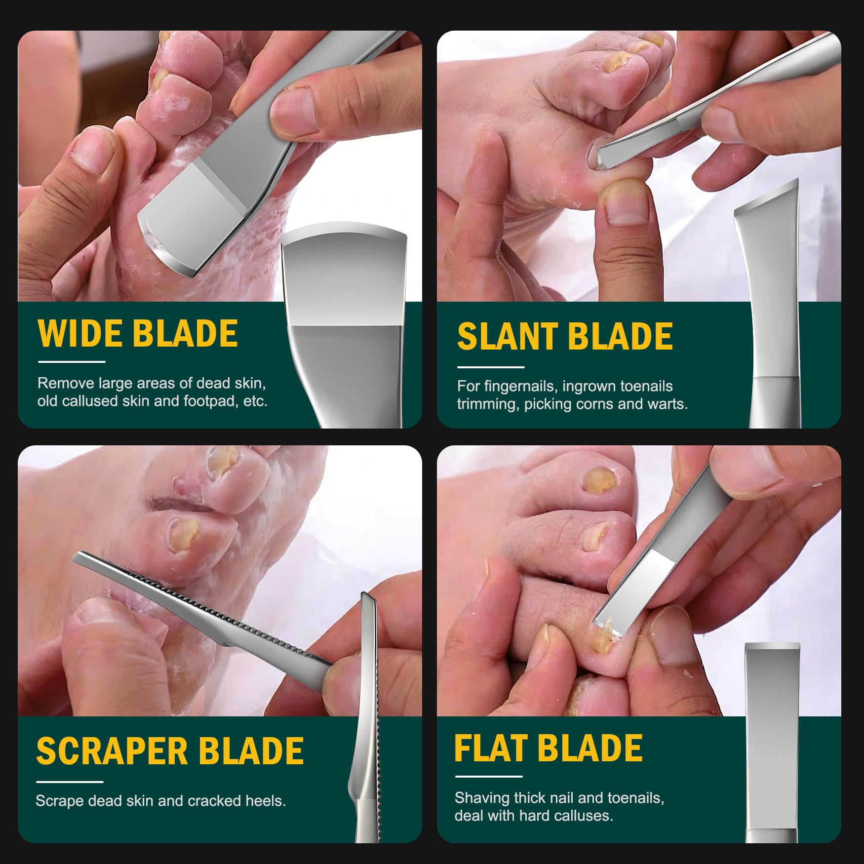 FVION Pedicure Knife Set slanted edge for comfortable ingrown nail care