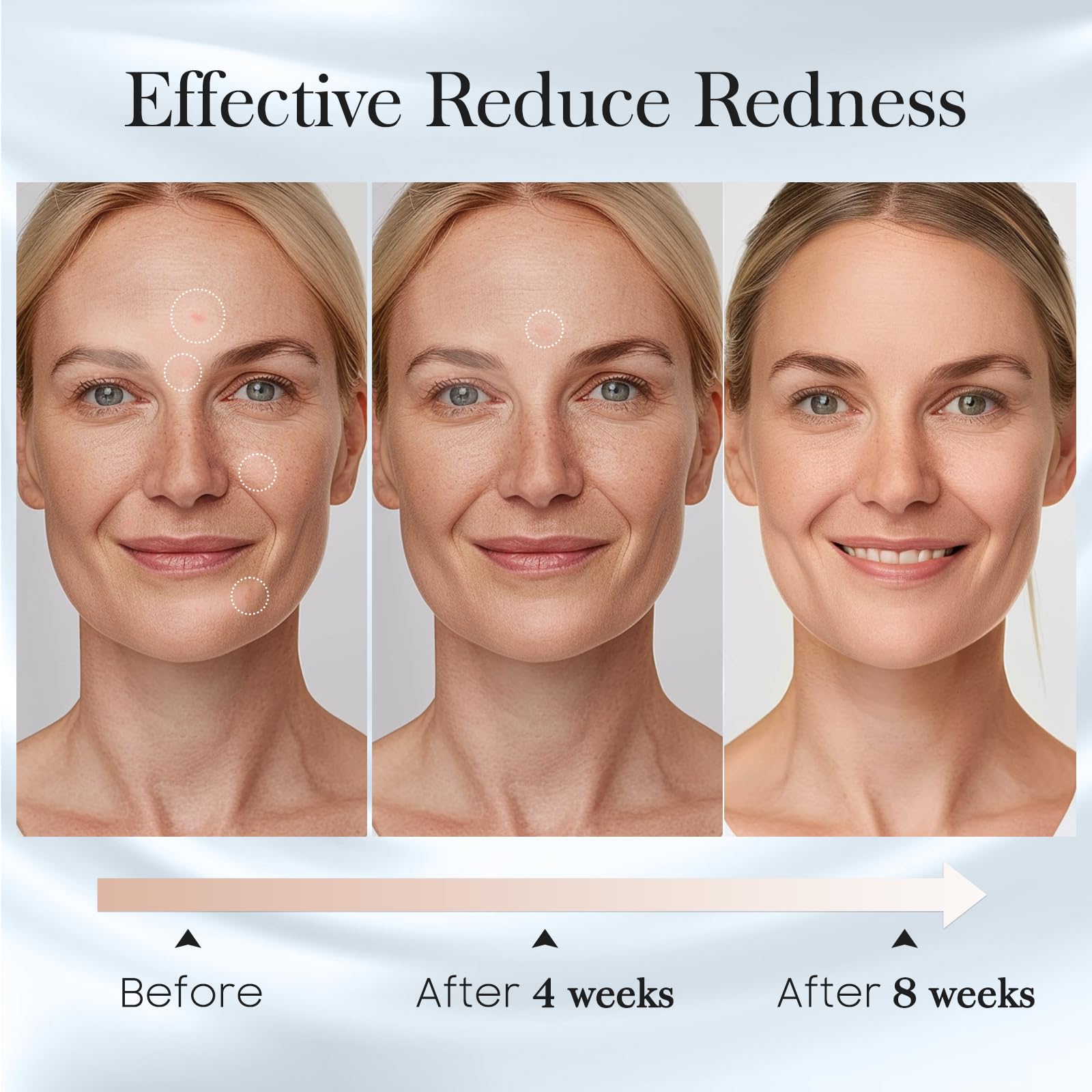 Fygrip hygienic 50-count pack keeps skin care routines tidy.
