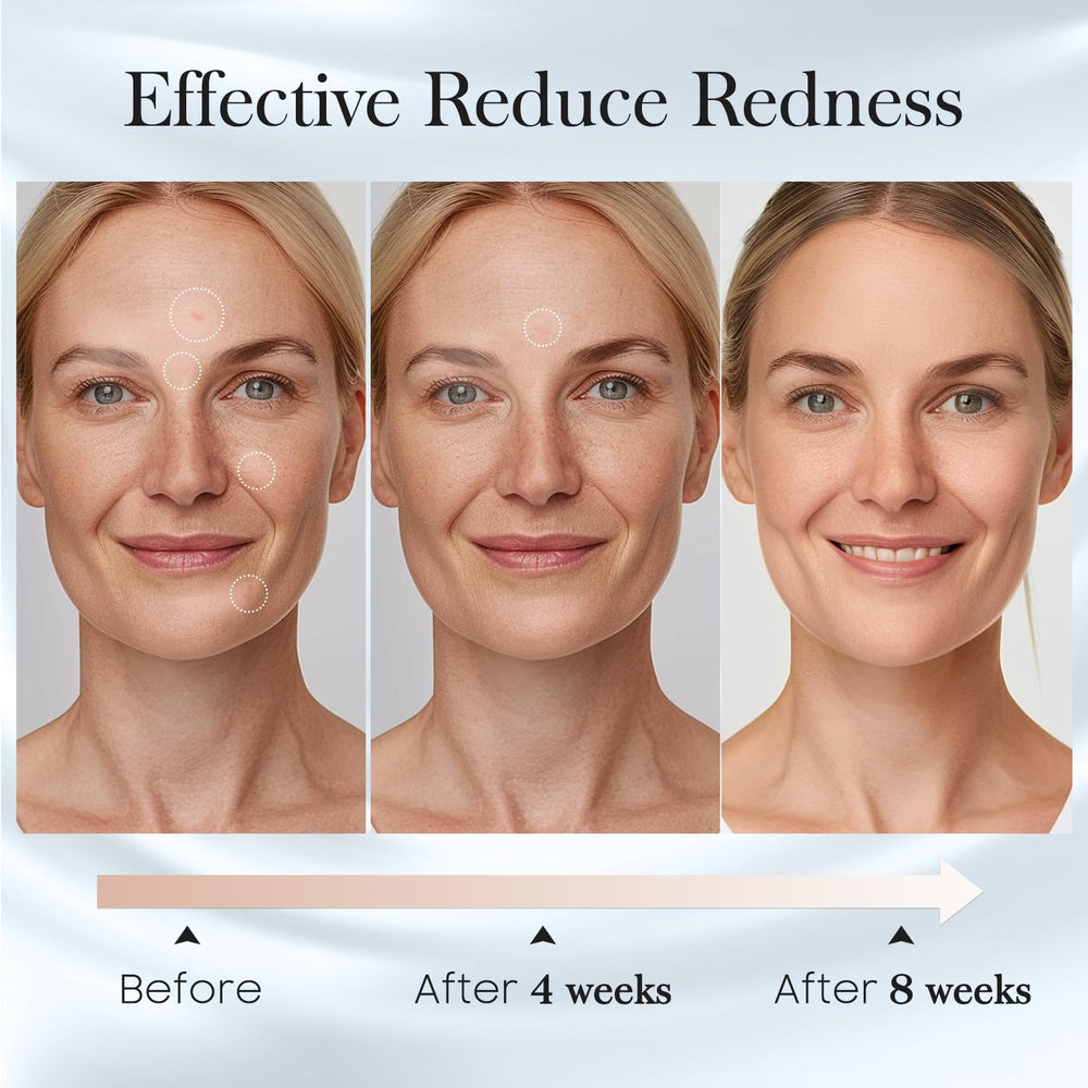 Fygrip hygienic 50-count pack keeps skin care routines tidy.