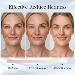 Fygrip hygienic 50-count pack keeps skin care routines tidy.