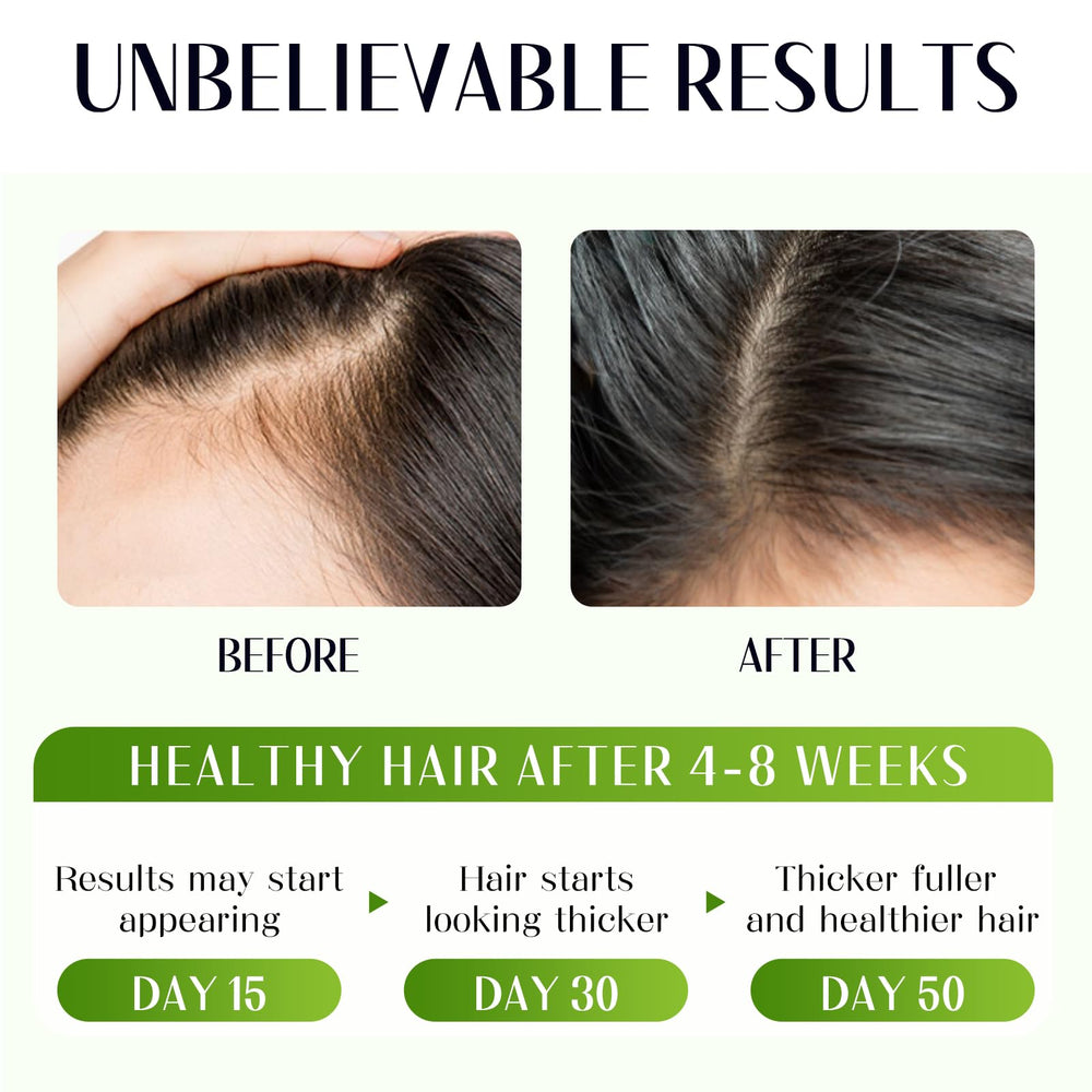 Gaayou Batana Oil with rosemary infusion emphasizes revitalized scalp care during application.