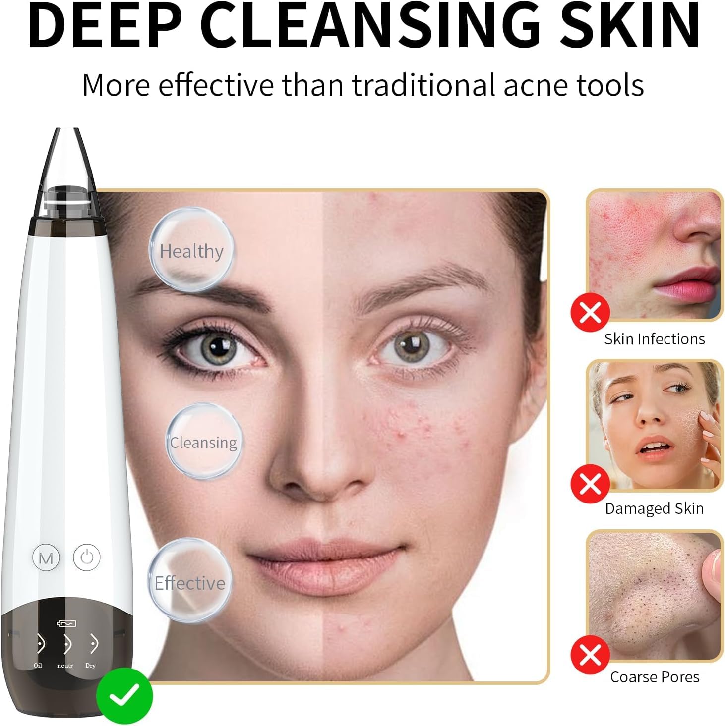 Gackoko Blackhead Remover shows suction levels for personalized cleansing.