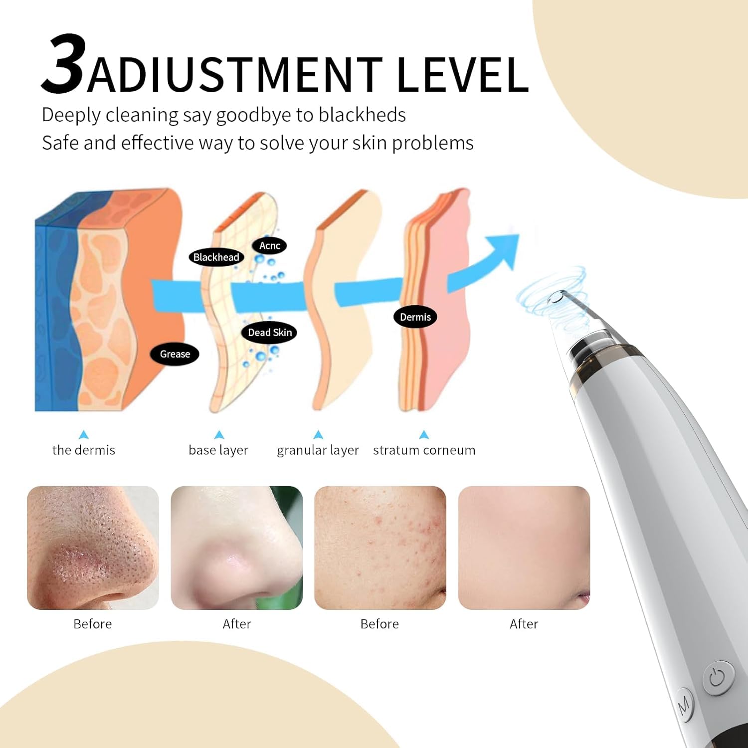 Gackoko Blackhead Remover USB rechargeable design keeps you powered during routines.