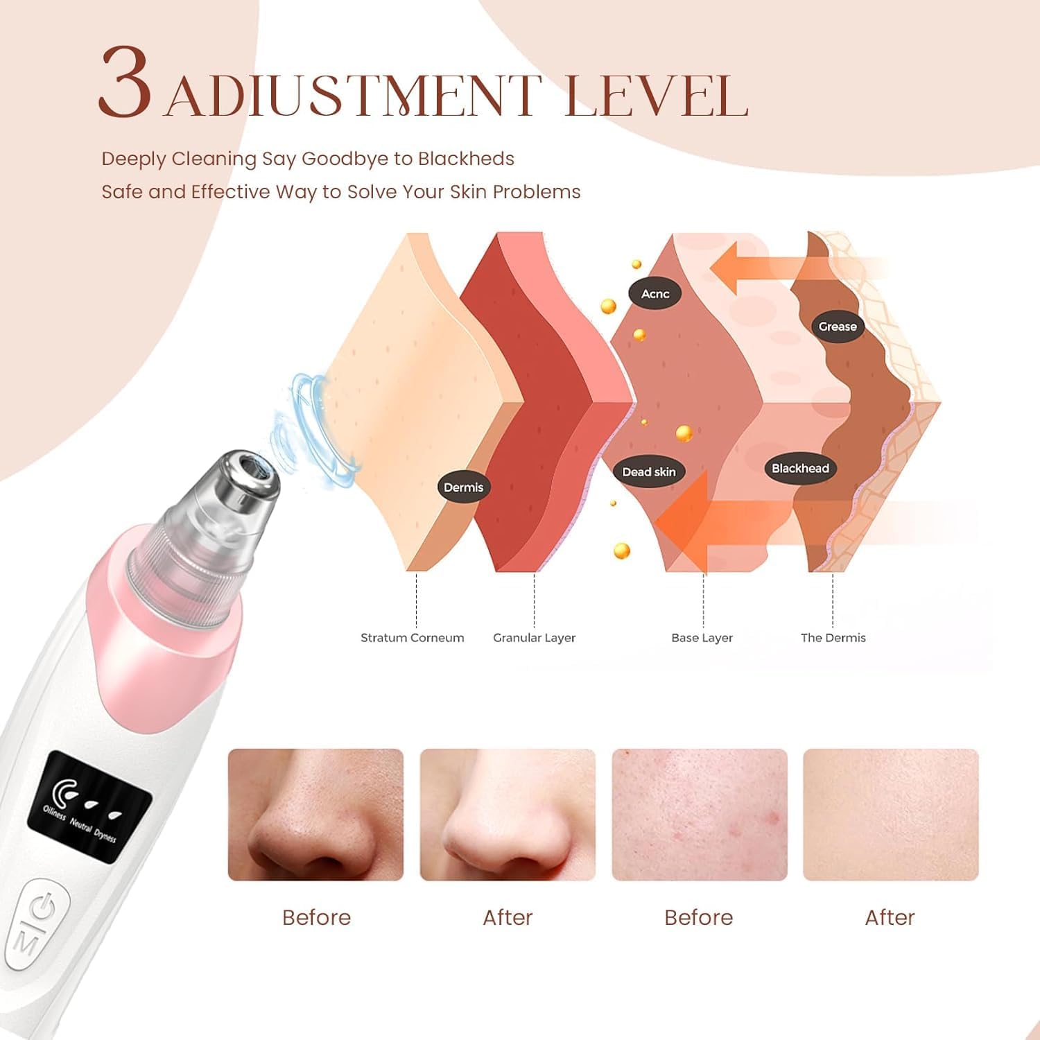 Gackoko pore vacuum suction levels show gentle to strong cleansing options