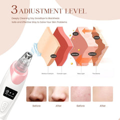 Gackoko pore vacuum suction levels show gentle to strong cleansing options