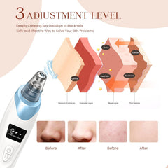 Five probes for targeted cleansing, addressing blackheads, dirt, and oil