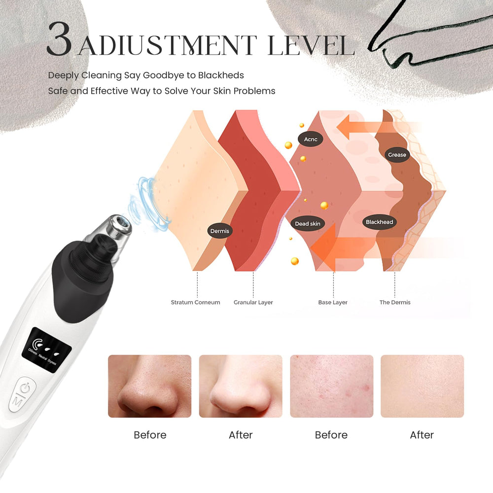 Gackoko Probes pack—five replaceable tips for targeted pore care.