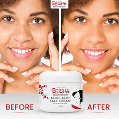 Geisha Kojic Acid Cream before-after demonstrates more even-toned skin result potential.