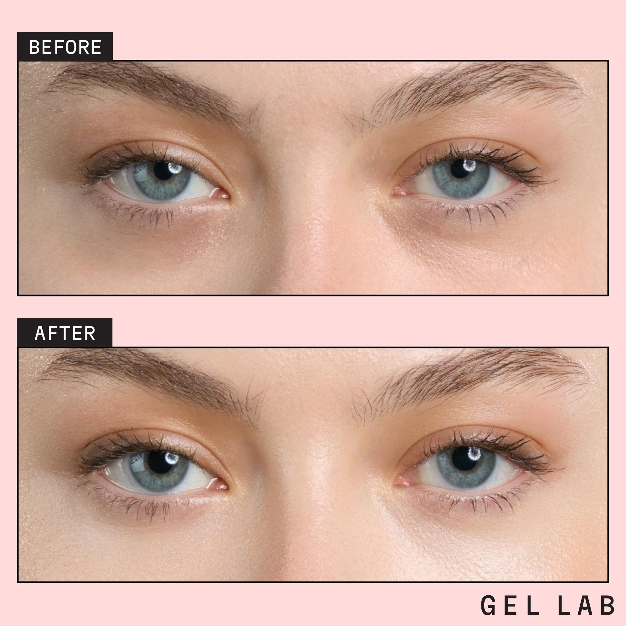 Gel Lab Renew patches laid out for easy at-home skincare routine