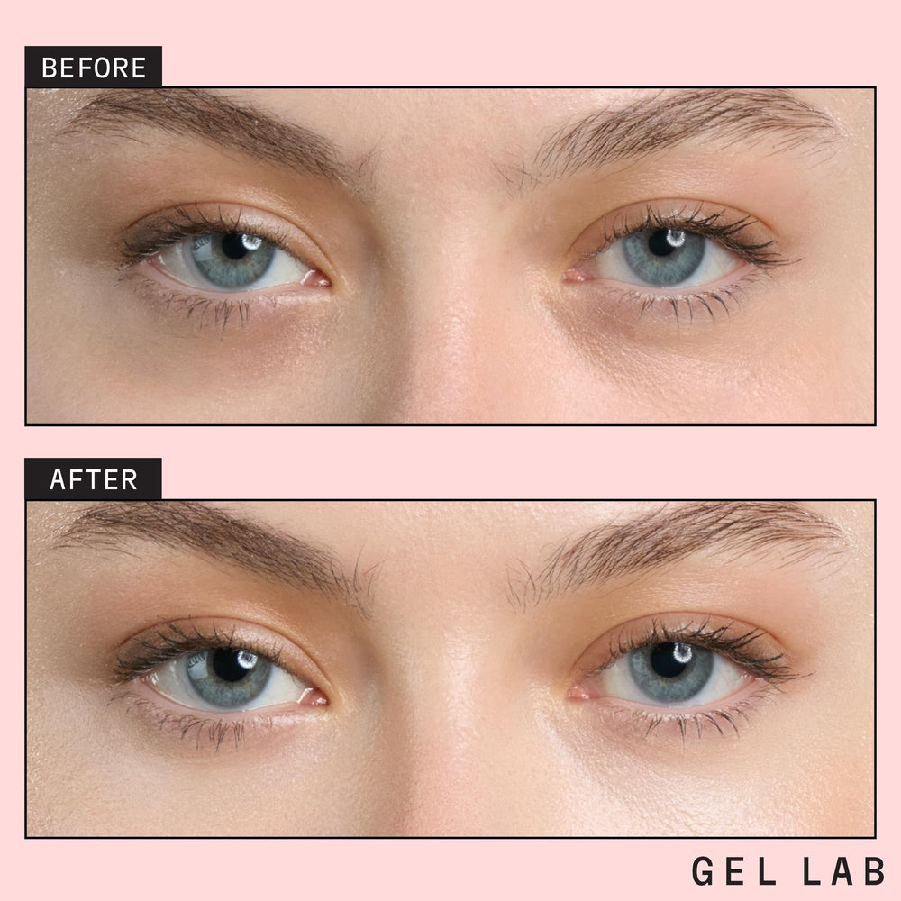 Gel Lab Renew patches laid out for easy at-home skincare routine