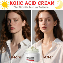 Generic Kojic Acid Cream body care showcases multi-area use.
