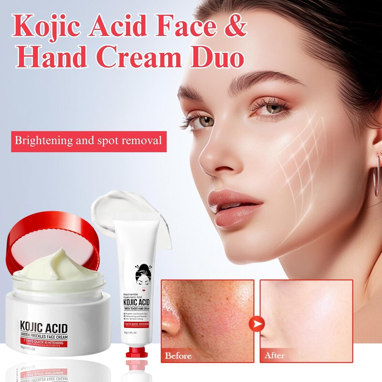Generic Kojic Acid Cream dark spots closeup hints at evening skin tone.