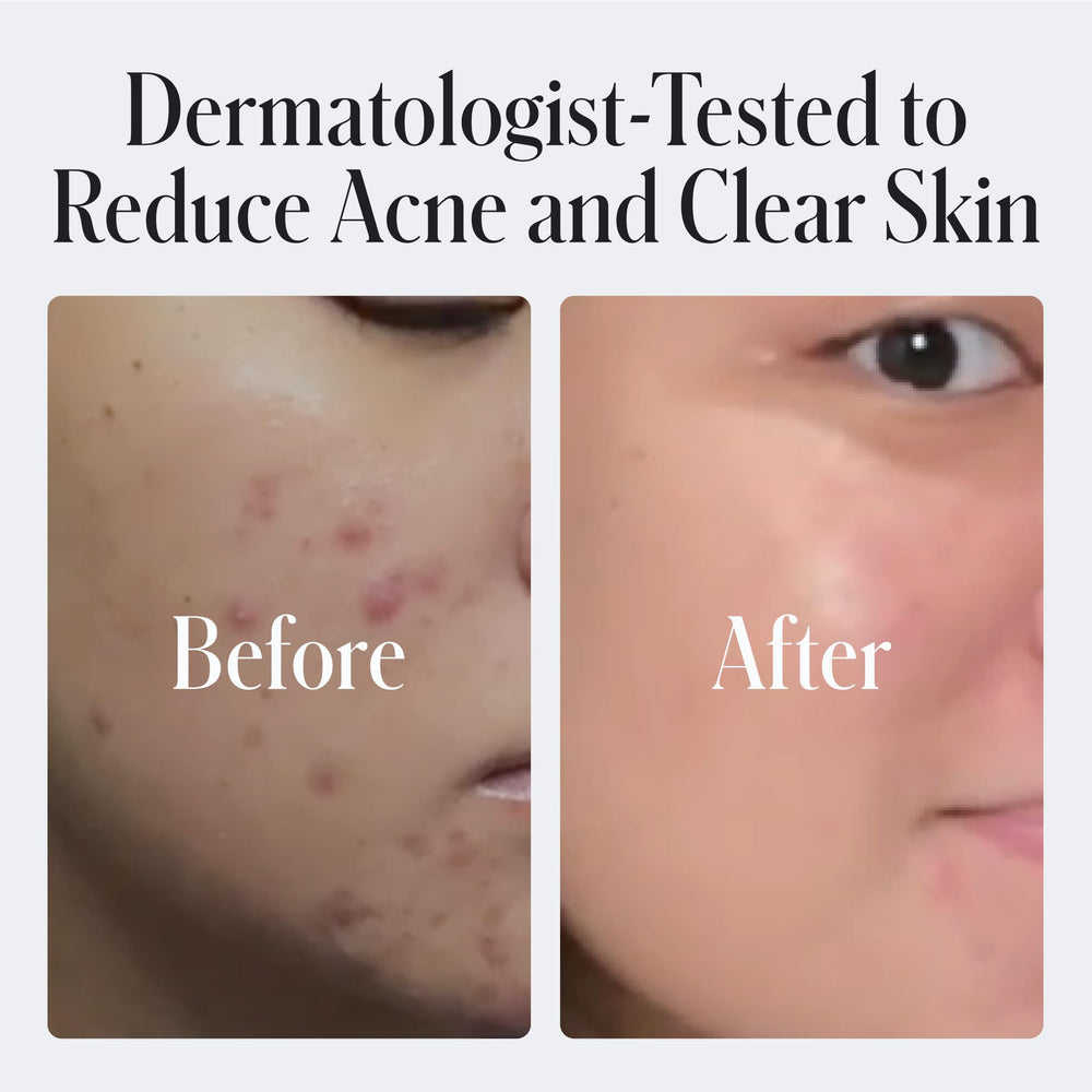 Geologie Daily Face Wash close-up on sensitive skin with gentle cleansing emphasis.