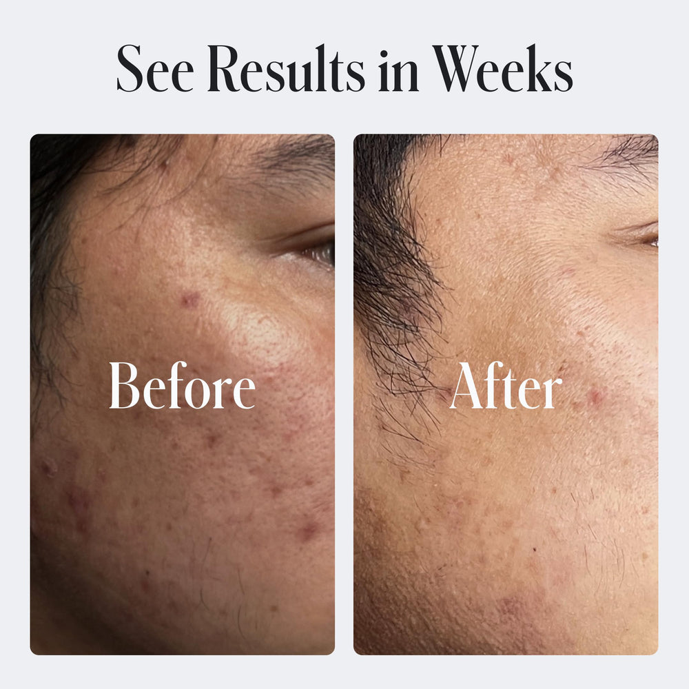 Geologie Skin Repair Moisturizer retinol percentage label highlights gentle renewal