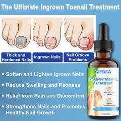 GIFBEA ergonomic nail lifter handles improve grip during trimming