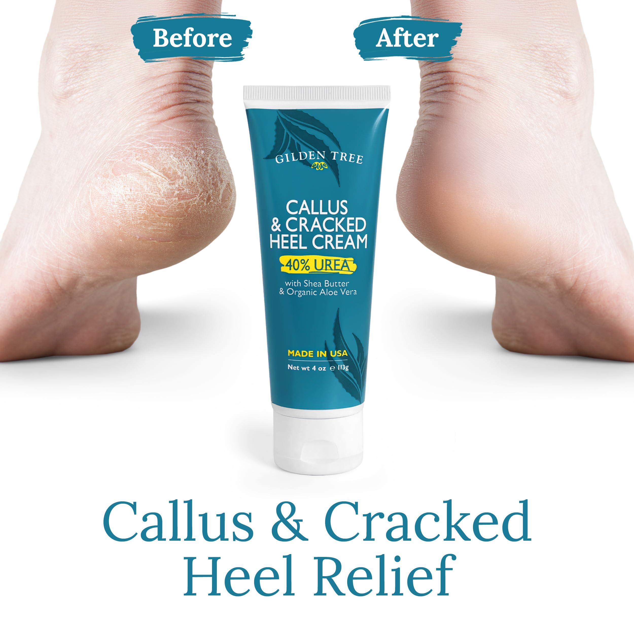 GILDEN TREE Urea Cream 40% cracked heel closeup highlights moisture