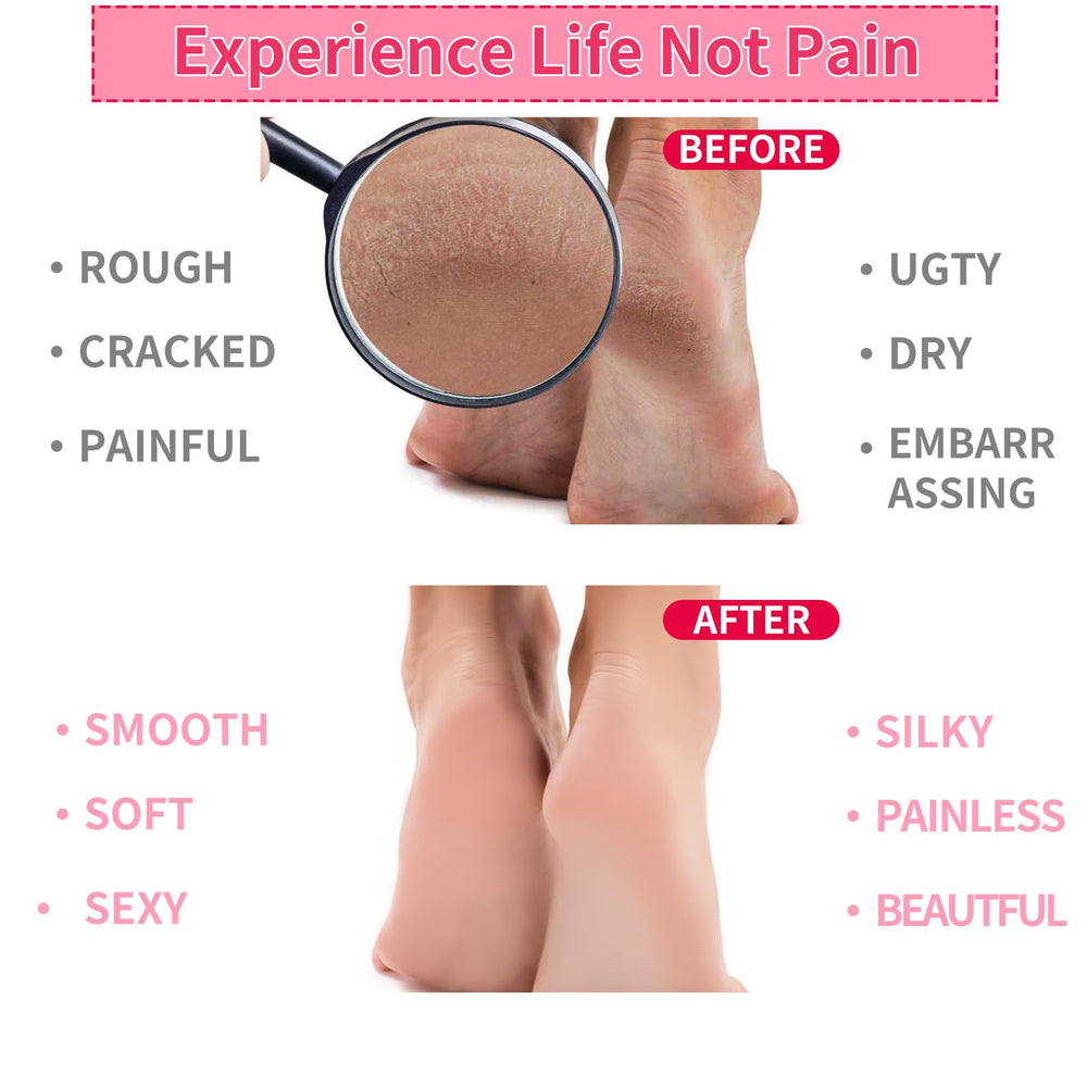 Giloner foot moisturizing socks on foot demonstrates comfortable at-home wear
